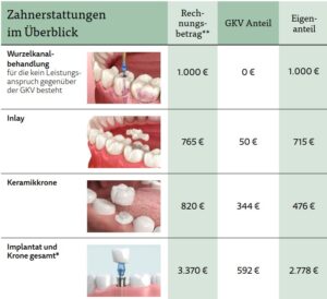 Lücke beim Zahnarzt - Notwendigkeit einer Zahnzusatzversicherung, Festzuschuss