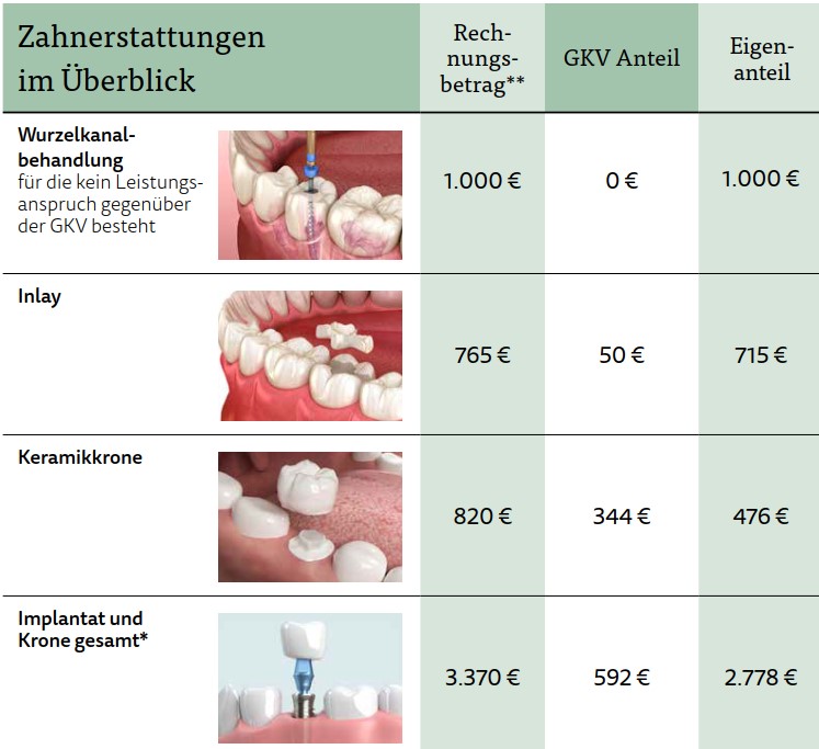 Lücke beim Zahnarzt - Notwendigkeit einer Zahnzusatzversicherung